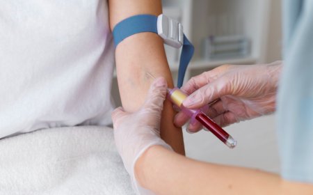 Unlocking the Power of Methylene Blue IV Drip: A Modern Approach to Cellular Health by Cure Cell